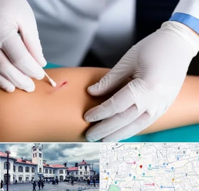 متخصص زخم عفونی در میدان شهرداری رشت 