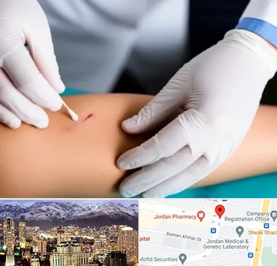 متخصص زخم عفونی در جردن 