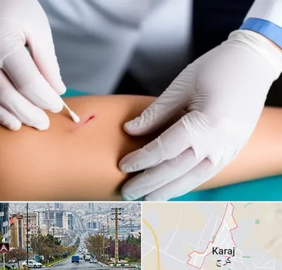 متخصص زخم عفونی در گوهردشت کرج 