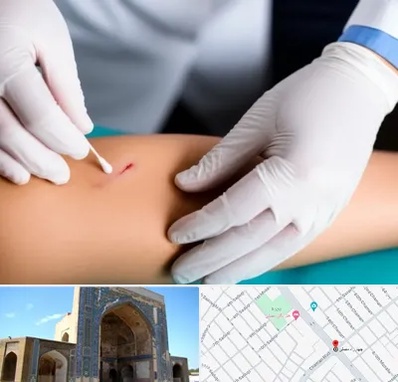 متخصص زخم عفونی در مصلی مشهد 