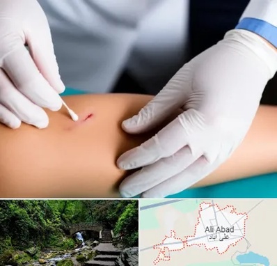 متخصص زخم عفونی در علی آباد کتول