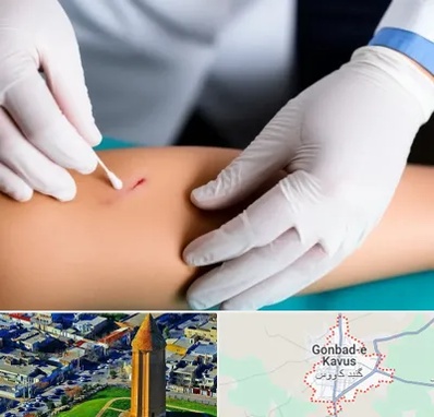 متخصص زخم عفونی در گنبد کاووس