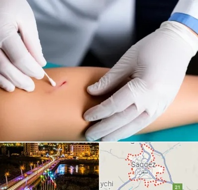 متخصص زخم عفونی در سقز