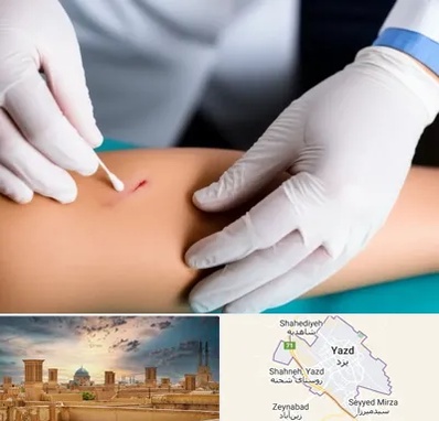 متخصص زخم عفونی در یزد