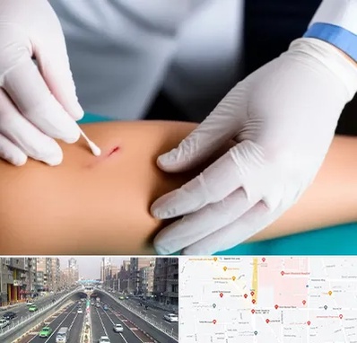 متخصص زخم عفونی در توحید 