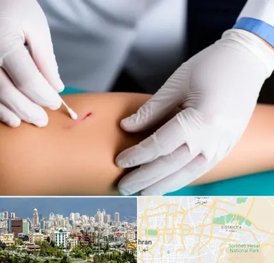 متخصص زخم عفونی در شرق تهران 