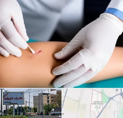 متخصص زخم عفونی در فاز یک اندیشه