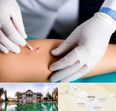 متخصص زخم عفونی در شیراز