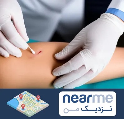 متخصص زخم عفونی در نزدیک من