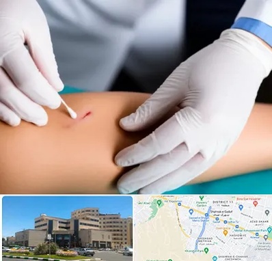 متخصص زخم عفونی در صیاد شیرازی مشهد 