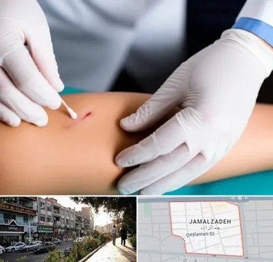 متخصص زخم عفونی در خیابان جمالزاده 