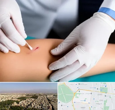 متخصص زخم عفونی در نازی آباد 