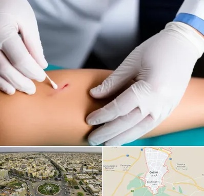 متخصص زخم عفونی در قزوین