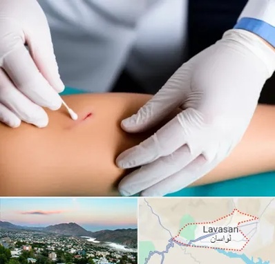 متخصص زخم عفونی در لواسان