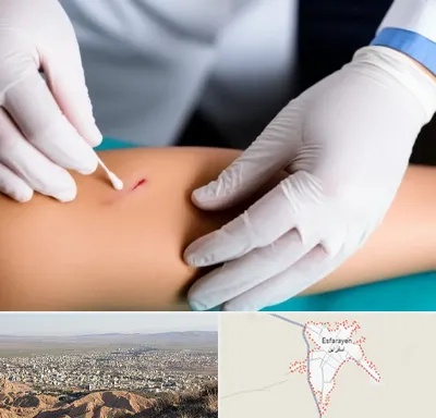 متخصص زخم عفونی در اسفراین