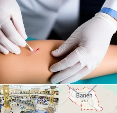 متخصص زخم عفونی در بانه