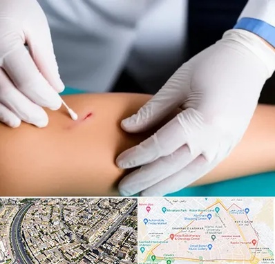 متخصص زخم عفونی در شهرک غرب مشهد 