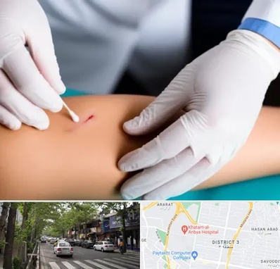 متخصص زخم عفونی در ظفر 