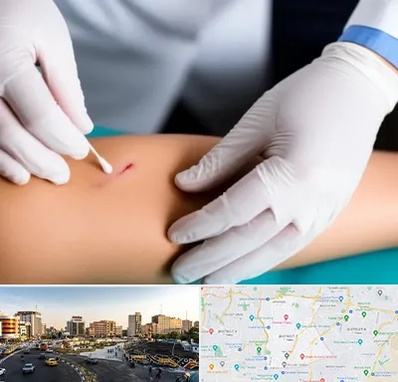 متخصص زخم عفونی در منطقه 7 تهران 