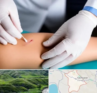 متخصص زخم عفونی در گچساران