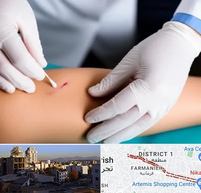 متخصص زخم عفونی در فرمانیه 