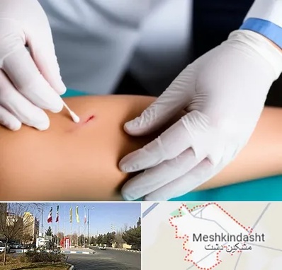 متخصص زخم عفونی در مشکین دشت