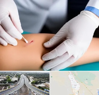 متخصص زخم عفونی در اندیمشک