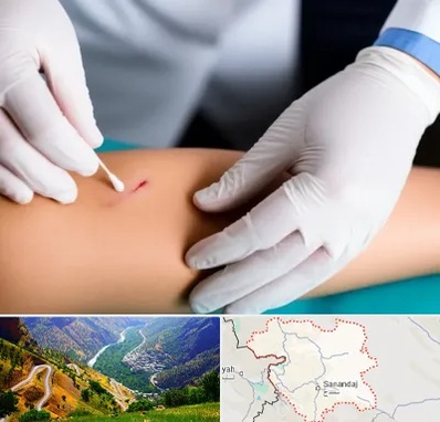 متخصص زخم عفونی در کردستان