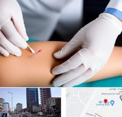 متخصص زخم عفونی در چهارراه طالقانی کرج 