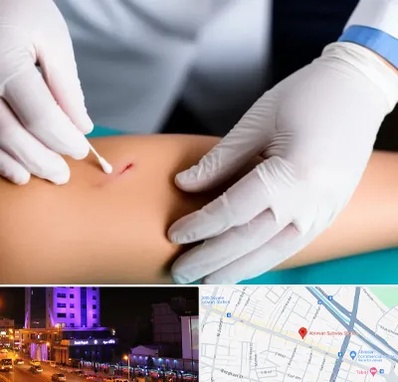 متخصص زخم عفونی در آبرسان تبریز 