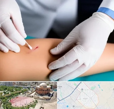 متخصص زخم عفونی در گلستان اسلامشهر 