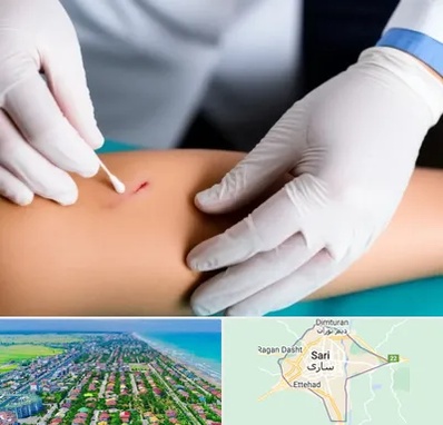 متخصص زخم عفونی در ساری