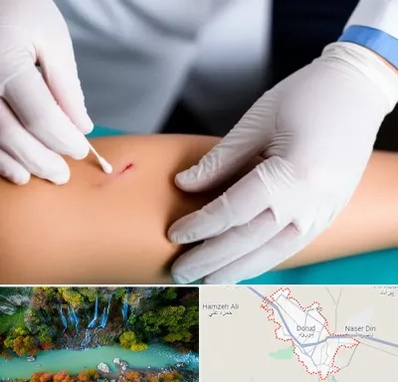 متخصص زخم عفونی در دورود