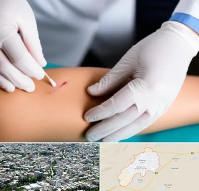 متخصص زخم عفونی در شاهرود