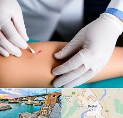 متخصص زخم عفونی در دزفول