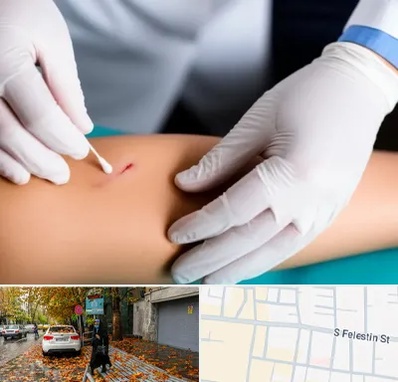 متخصص زخم عفونی در خیابان فلسطین