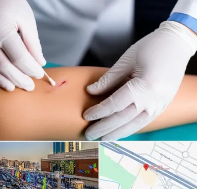 متخصص زخم عفونی در لاله پارک تبریز 