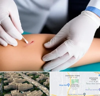 متخصص زخم عفونی در اکباتان 