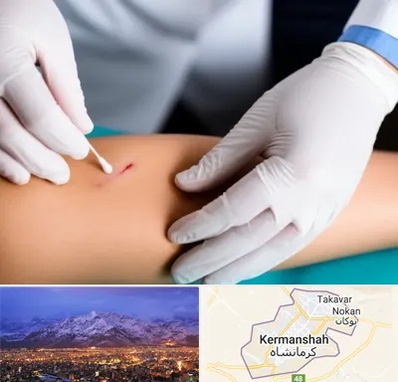 متخصص زخم عفونی در کرمانشاه