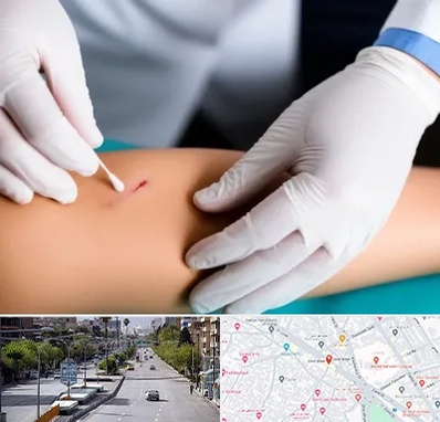 متخصص زخم عفونی در خیابان زند شیراز 