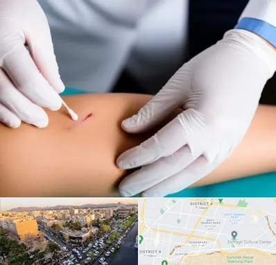 متخصص زخم عفونی در تهرانپارس 