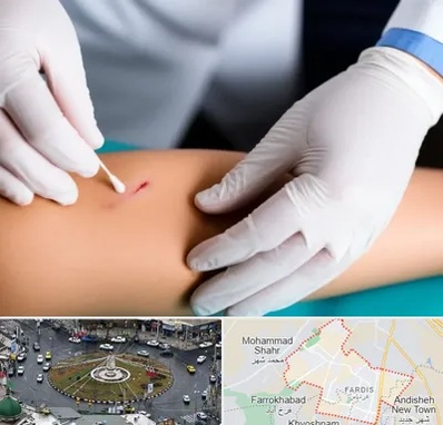 متخصص زخم عفونی در فردیس کرج 