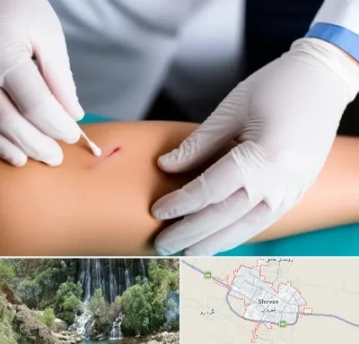 متخصص زخم عفونی در شیروان