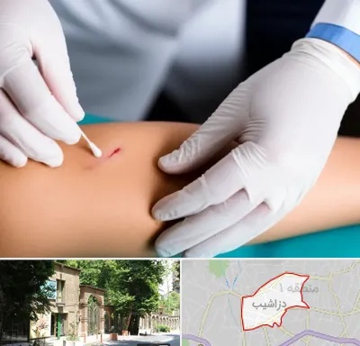 متخصص زخم عفونی در دزاشیب