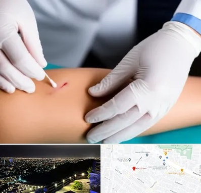 متخصص زخم عفونی در هفت تیر مشهد 