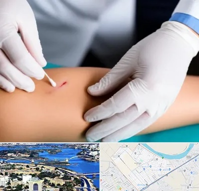 متخصص زخم عفونی در کوروش اهواز 