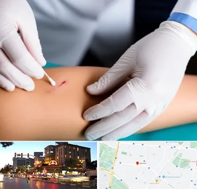 متخصص زخم عفونی در بلوار سجاد مشهد 