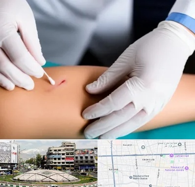 متخصص زخم عفونی در مرکز تهران 