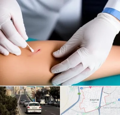 متخصص زخم عفونی در خطیب تبریز 