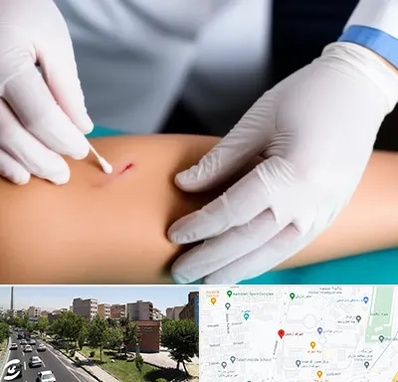 متخصص زخم عفونی در شهرک آزمایش 